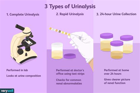 Urinalysis: Purposes, Types, Results .